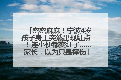 密密麻麻！宁波4岁孩子身上突然出现红点！连小便都变红了……家长：以为只是摔伤