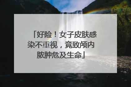 好险！女子皮肤感染不重视，竟致颅内脓肿危及生命