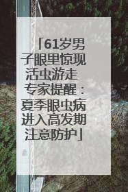 61岁男子眼里惊现活虫游走 专家提醒：夏季眼虫病进入高发期注意防护